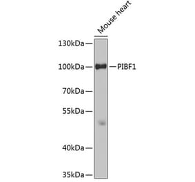 Western Blot - Anti-PIBF Antibody (A14334) - Antibodies.com