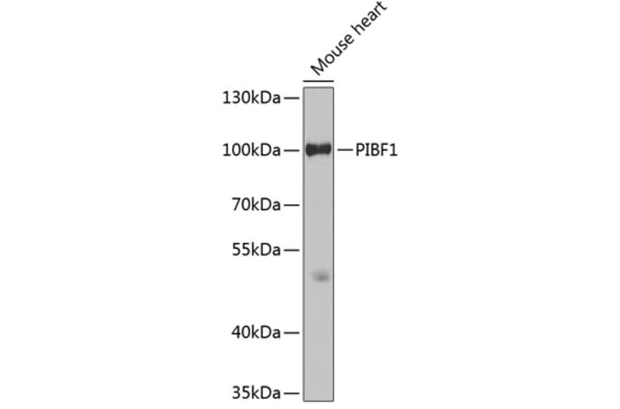 Western Blot - Anti-PIBF Antibody (A14334) - Antibodies.com
