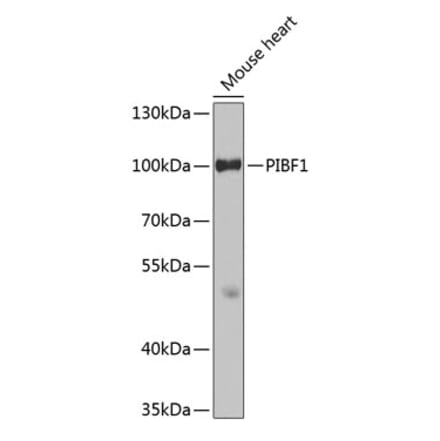 Western Blot - Anti-PIBF Antibody (A14334) - Antibodies.com