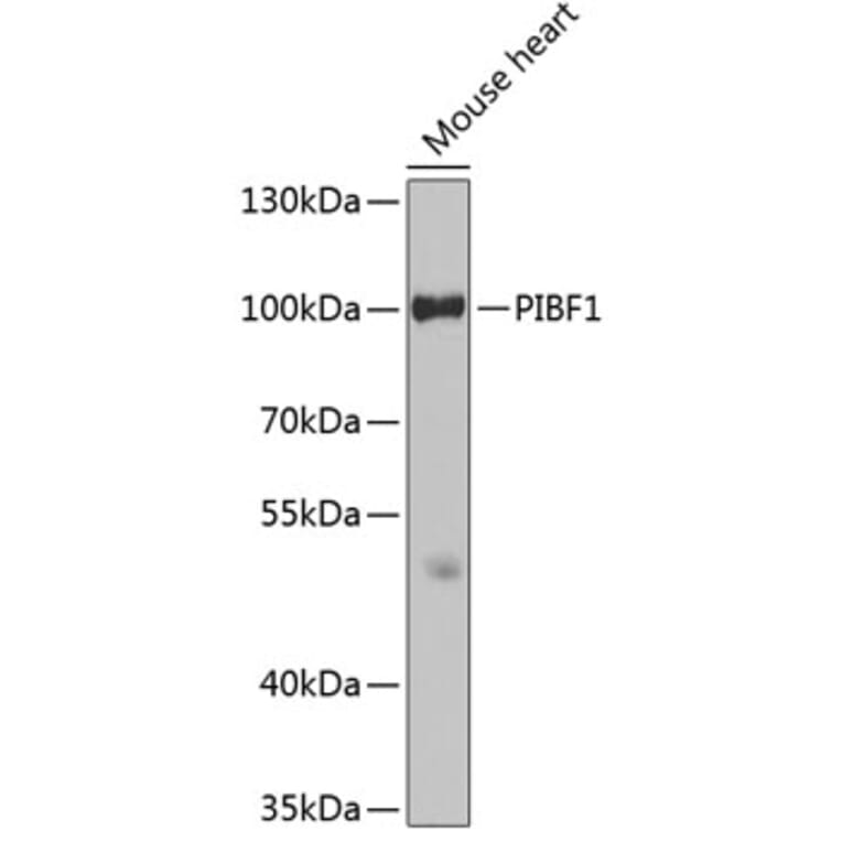 Western Blot - Anti-PIBF Antibody (A14334) - Antibodies.com