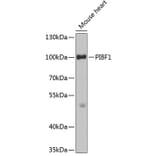Western Blot - Anti-PIBF Antibody (A14334) - Antibodies.com