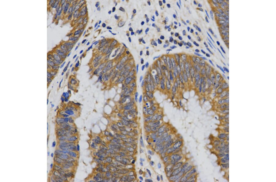 Immunohistochemistry - Anti-PIBF Antibody (A14334) - Antibodies.com