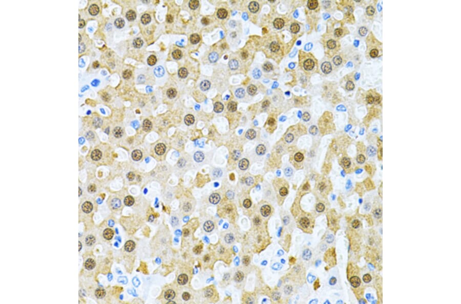 Immunohistochemistry - Anti-PIBF Antibody (A14334) - Antibodies.com