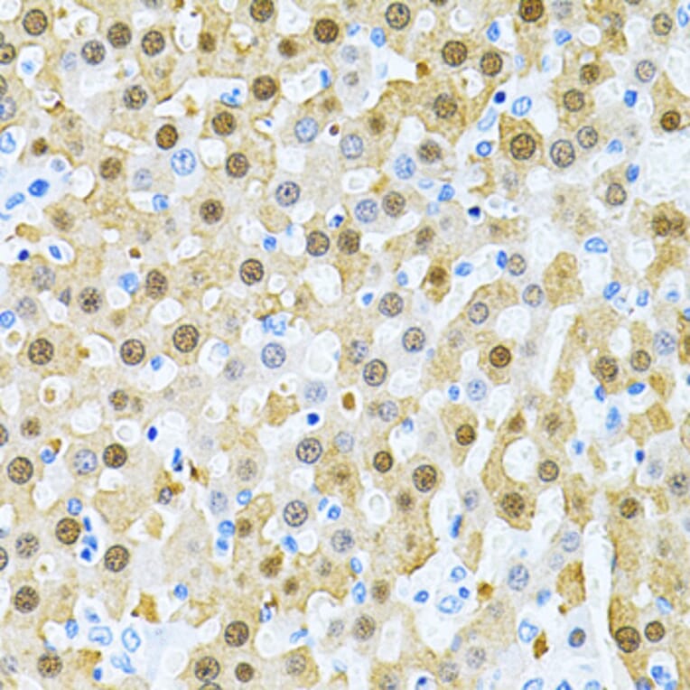 Immunohistochemistry - Anti-PIBF Antibody (A14334) - Antibodies.com