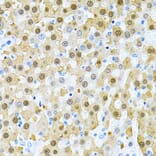 Immunohistochemistry - Anti-PIBF Antibody (A14334) - Antibodies.com