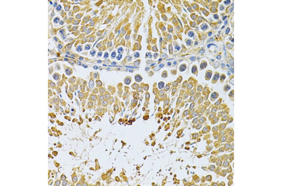 Immunohistochemistry - Anti-PIBF Antibody (A14334) - Antibodies.com