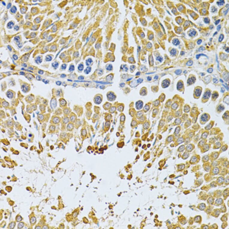 Immunohistochemistry - Anti-PIBF Antibody (A14334) - Antibodies.com