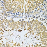 Immunohistochemistry - Anti-PIBF Antibody (A14334) - Antibodies.com