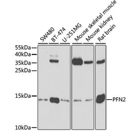 Western Blot - Anti-Profilin 2 Antibody (A14335) - Antibodies.com