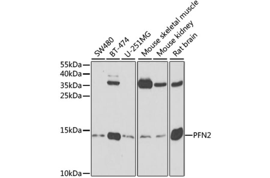 Western Blot - Anti-Profilin 2 Antibody (A14335) - Antibodies.com