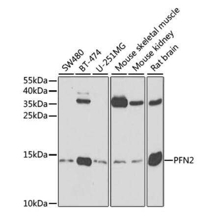 Western Blot - Anti-Profilin 2 Antibody (A14335) - Antibodies.com