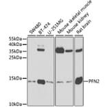 Western Blot - Anti-Profilin 2 Antibody (A14335) - Antibodies.com