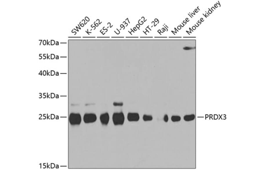 Western Blot - Anti-PRDX3 Antibody (A3076) - Antibodies.com