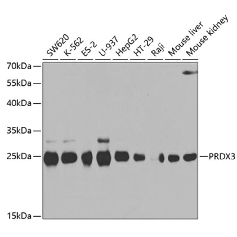 Western Blot - Anti-PRDX3 Antibody (A3076) - Antibodies.com