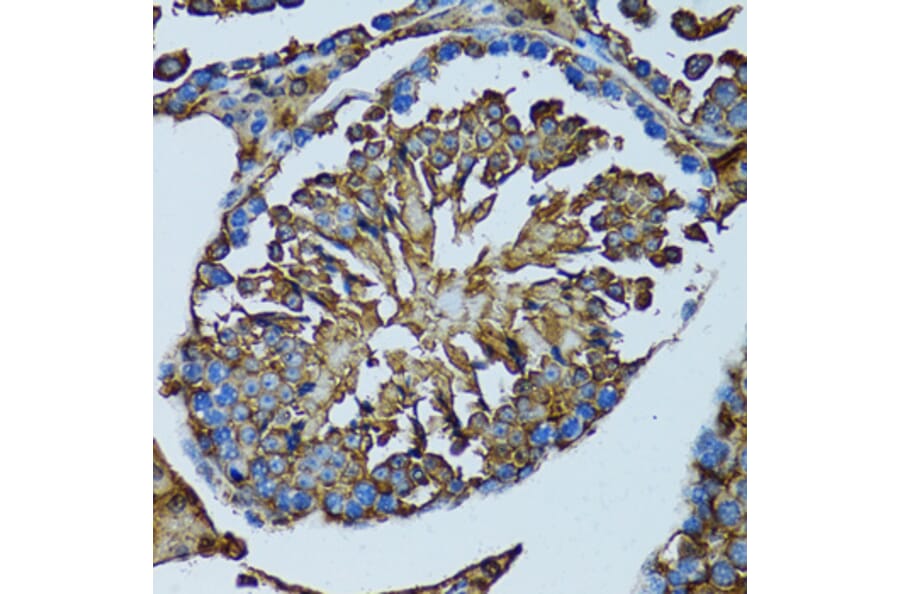 Immunohistochemistry - Anti-PRDX3 Antibody (A3076) - Antibodies.com
