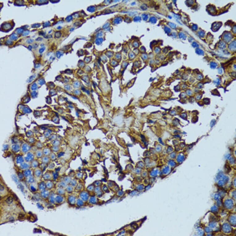 Immunohistochemistry - Anti-PRDX3 Antibody (A3076) - Antibodies.com