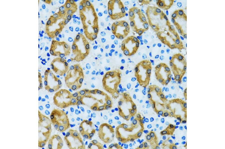Immunohistochemistry - Anti-PRDX3 Antibody (A3076) - Antibodies.com