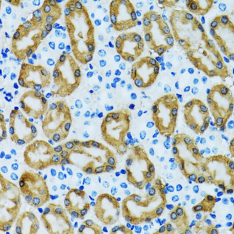 Immunohistochemistry - Anti-PRDX3 Antibody (A3076) - Antibodies.com