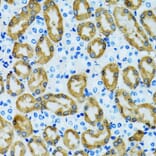 Immunohistochemistry - Anti-PRDX3 Antibody (A3076) - Antibodies.com