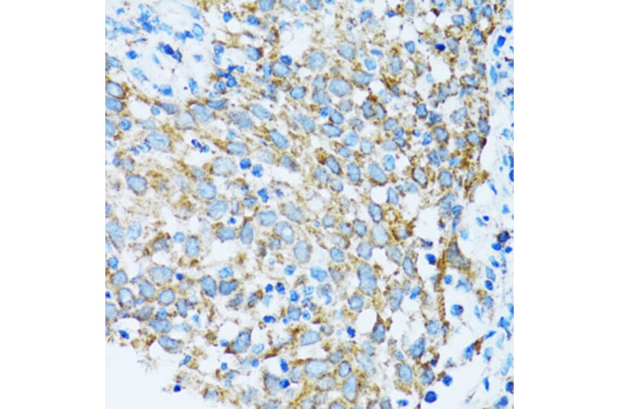 Immunohistochemistry - Anti-PRDX3 Antibody (A3076) - Antibodies.com