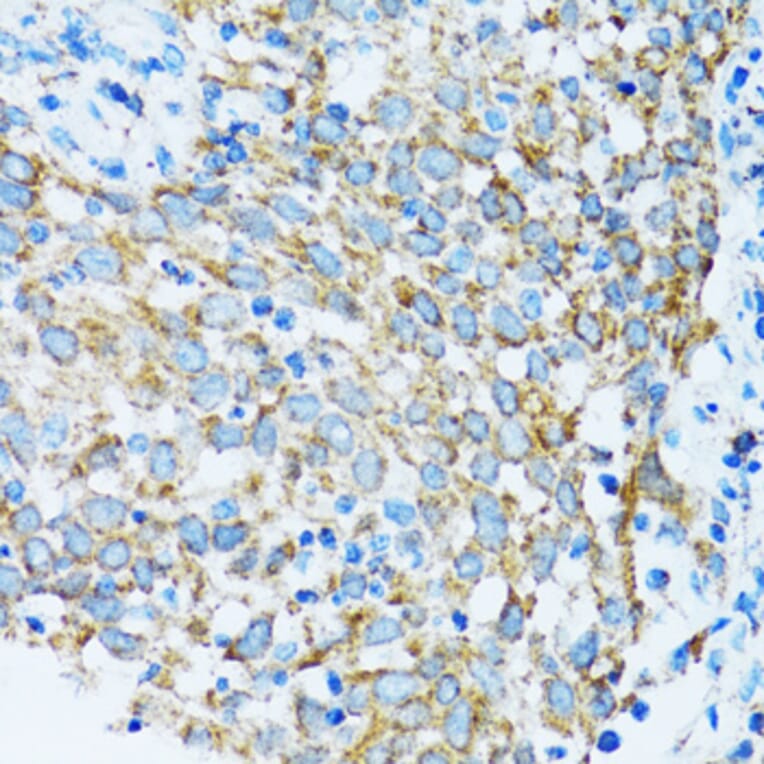 Immunohistochemistry - Anti-PRDX3 Antibody (A3076) - Antibodies.com