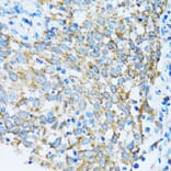 Immunohistochemistry - Anti-PRDX3 Antibody (A3076) - Antibodies.com