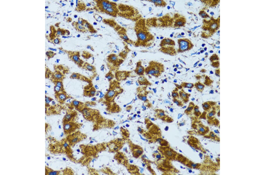 Immunohistochemistry - Anti-PRDX3 Antibody (A3076) - Antibodies.com