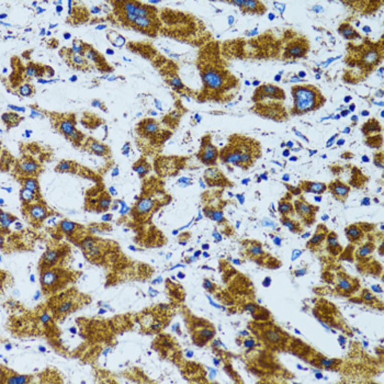 Immunohistochemistry - Anti-PRDX3 Antibody (A3076) - Antibodies.com