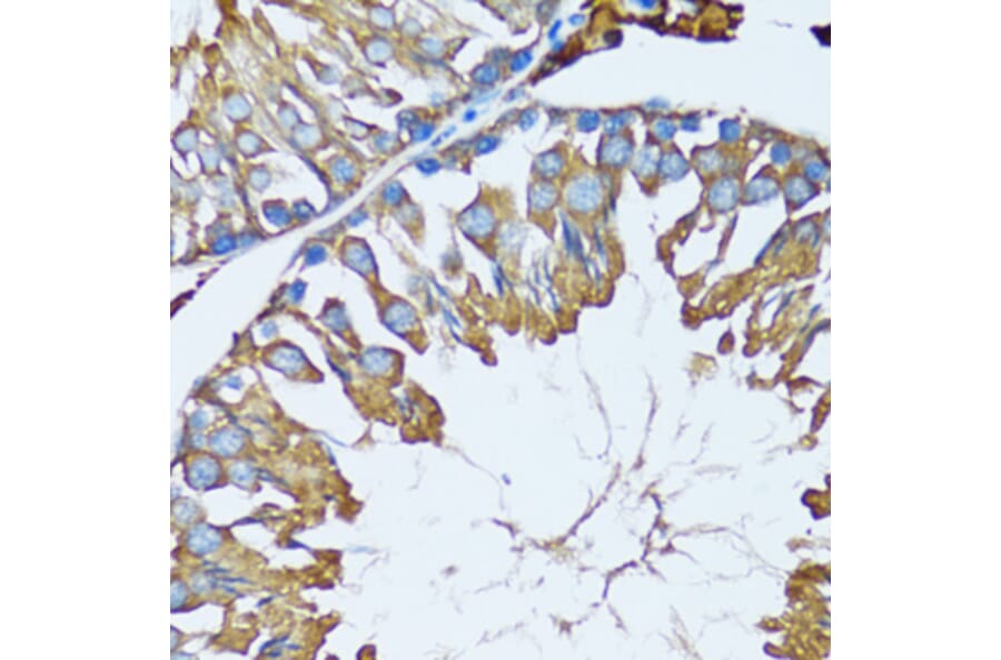 Immunohistochemistry - Anti-PRDX3 Antibody (A3076) - Antibodies.com