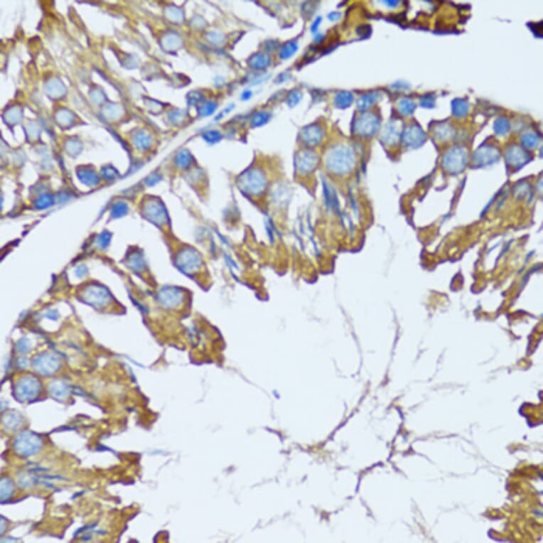 Immunohistochemistry - Anti-PRDX3 Antibody (A3076) - Antibodies.com