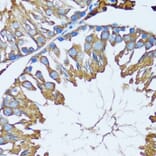 Immunohistochemistry - Anti-PRDX3 Antibody (A3076) - Antibodies.com