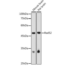 Western Blot - Anti-RAD52 Antibody (A14337) - Antibodies.com