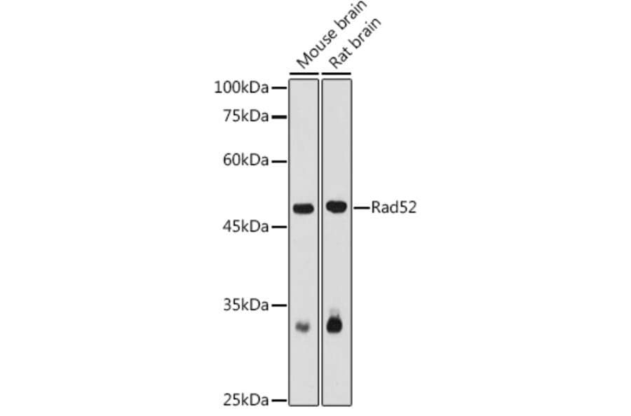 Western Blot - Anti-RAD52 Antibody (A14337) - Antibodies.com