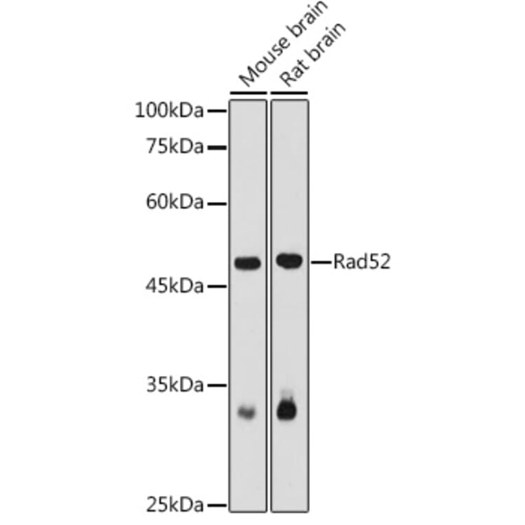Western Blot - Anti-RAD52 Antibody (A14337) - Antibodies.com