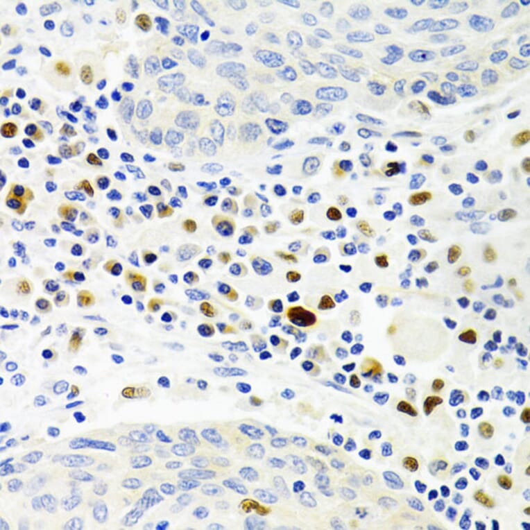 Immunohistochemistry - Anti-Gemin 2 Antibody (A14339) - Antibodies.com
