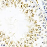 Immunohistochemistry - Anti-Gemin 2 Antibody (A14339) - Antibodies.com