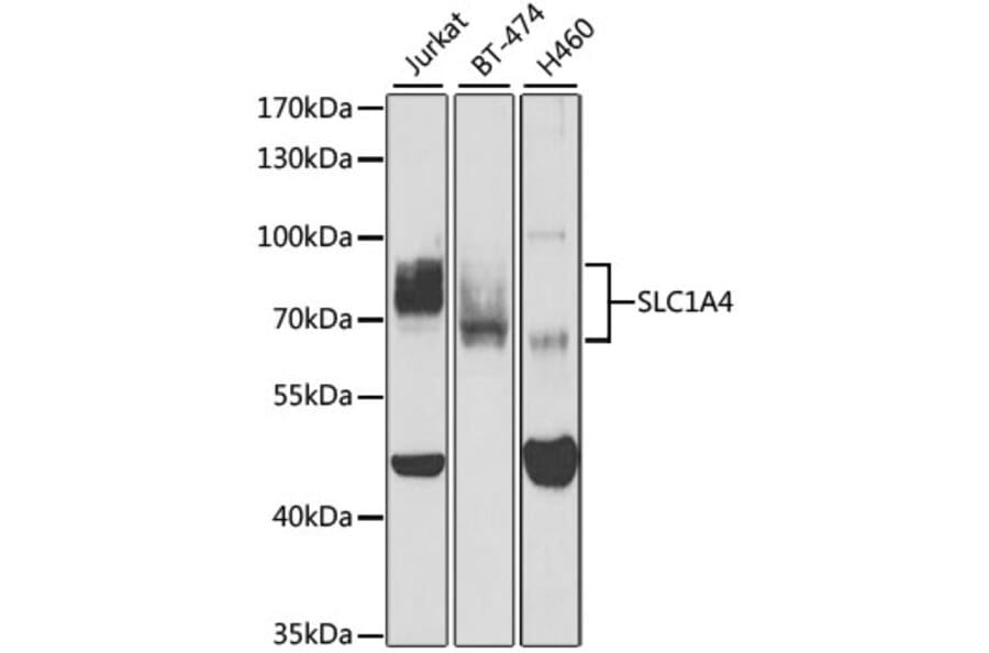 Western Blot - Anti-SLC1A4 Antibody (A3084) - Antibodies.com