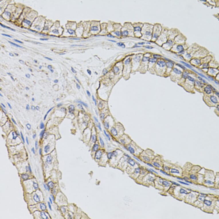 Immunohistochemistry - Anti-SLC1A4 Antibody (A3084) - Antibodies.com