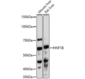 Western Blot - Anti-HNF-1B Antibody (A14345) - Antibodies.com
