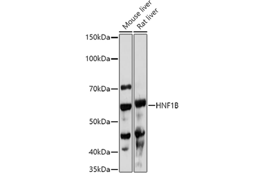 Western Blot - Anti-HNF-1B Antibody (A14345) - Antibodies.com