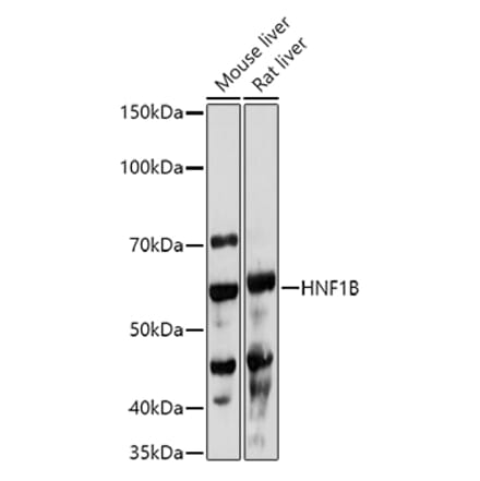 Western Blot - Anti-HNF-1B Antibody (A14345) - Antibodies.com