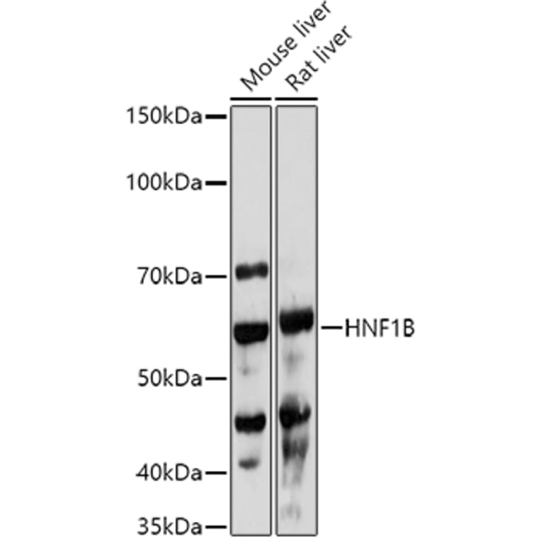 Western Blot - Anti-HNF-1B Antibody (A14345) - Antibodies.com