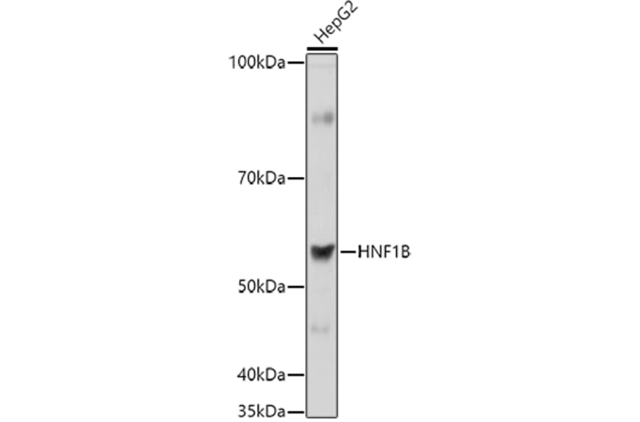 Western Blot - Anti-HNF-1B Antibody (A14345) - Antibodies.com