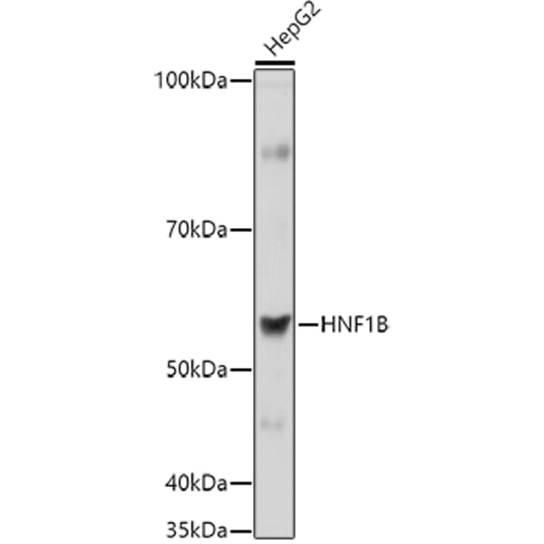 Western Blot - Anti-HNF-1B Antibody (A14345) - Antibodies.com
