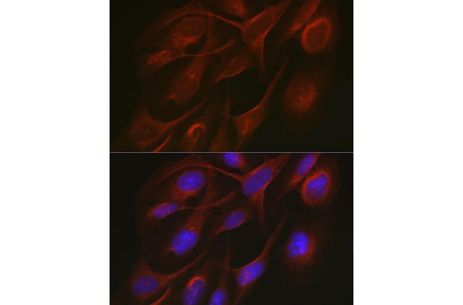Immunofluorescence - Anti-TRAF7 Antibody (A14346) - Antibodies.com