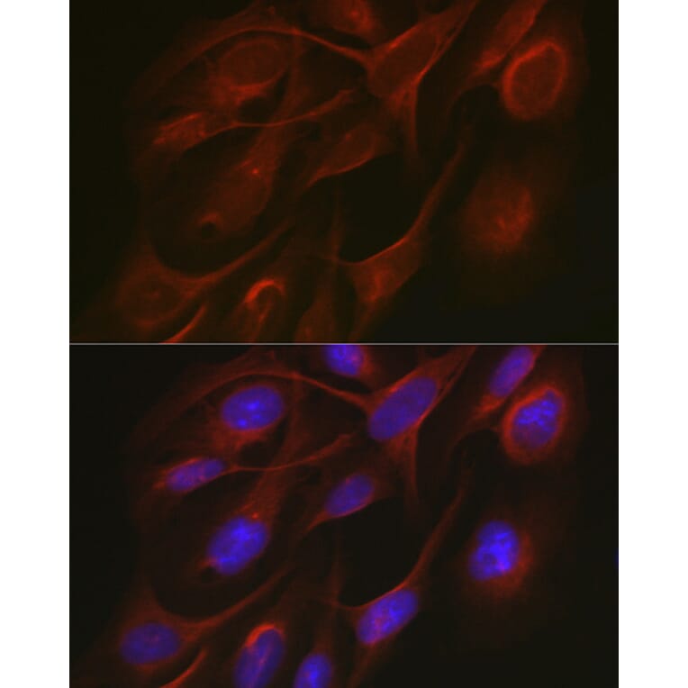 Immunofluorescence - Anti-TRAF7 Antibody (A14346) - Antibodies.com