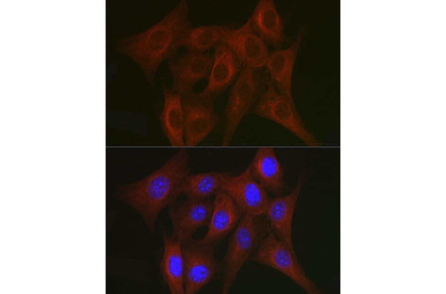 Immunofluorescence - Anti-TRAF7 Antibody (A14346) - Antibodies.com
