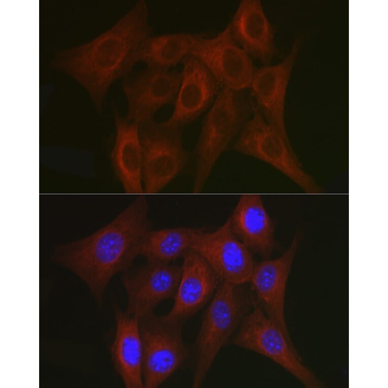 Immunofluorescence - Anti-TRAF7 Antibody (A14346) - Antibodies.com