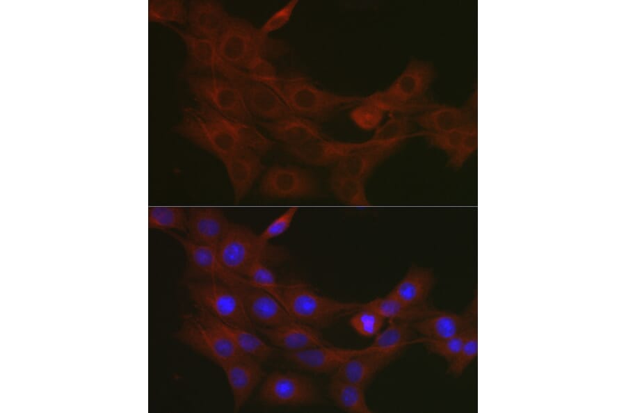 Immunofluorescence - Anti-TRAF7 Antibody (A14346) - Antibodies.com