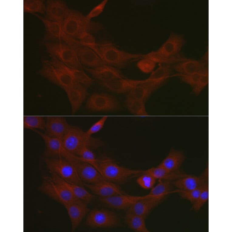 Immunofluorescence - Anti-TRAF7 Antibody (A14346) - Antibodies.com
